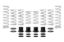 Picture of Eibach Coil Spring Set - E85-209-003-02-22