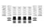 Picture of Eibach Coil Spring Set - E85-209-006-02-22