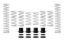 Picture of Eibach Coil Spring Set - E85-209-017-03-22